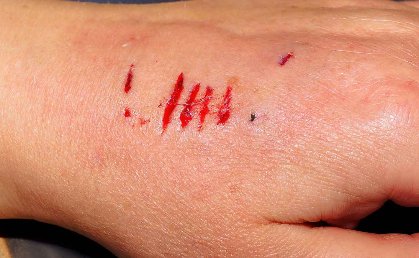 What to Do If Someone Sues You for a Dog Bite